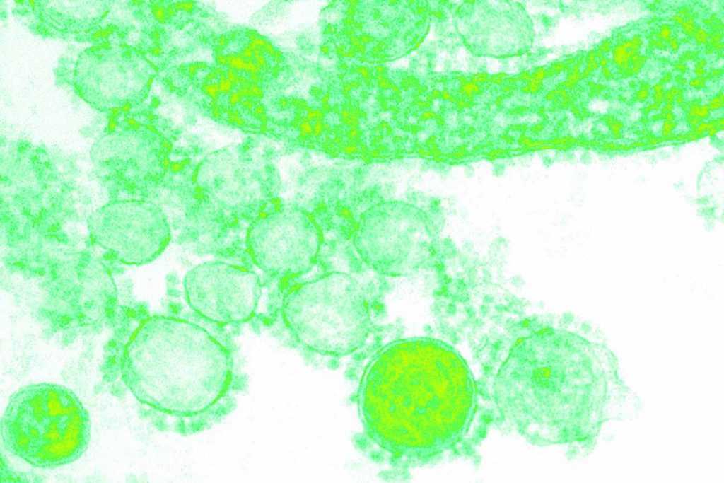 septic bacteria additive