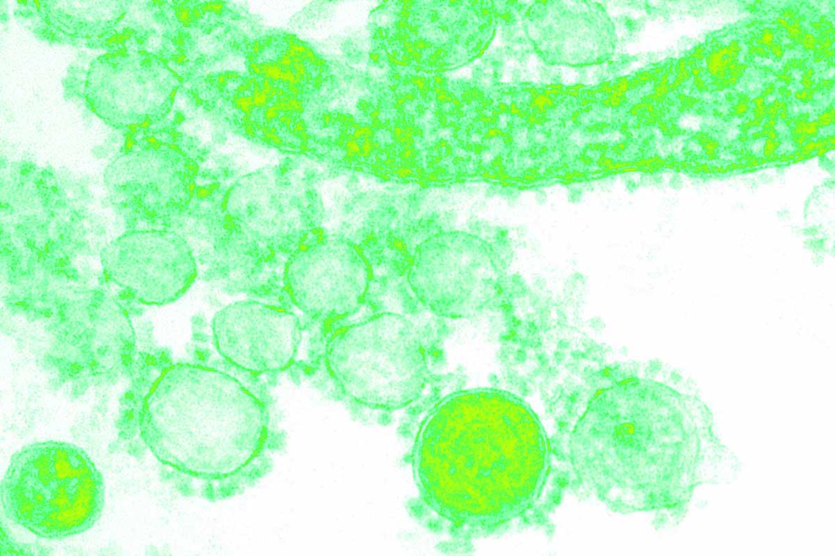 What type of septic bacteria additive is right for your system? Banner Image